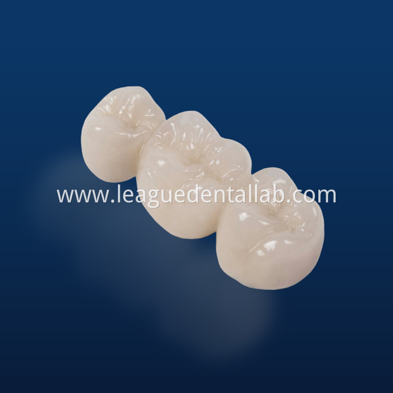 Full Zirconia crown,Full contour zirconia,Solid Zirconia,Zirconia,Monolithic Zirconia